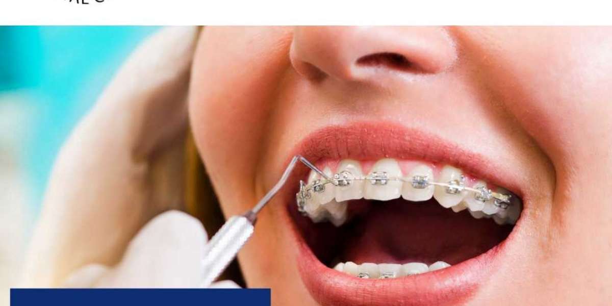 Life With Teeth Braces: What Is It Really Like?