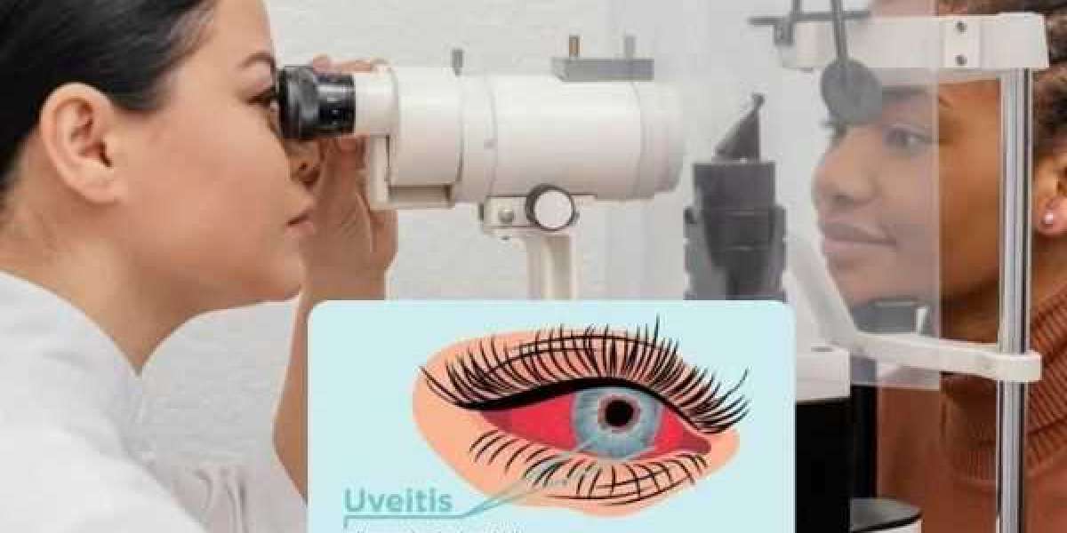 What are Some Benefits Associated with Uveitis Treatment?