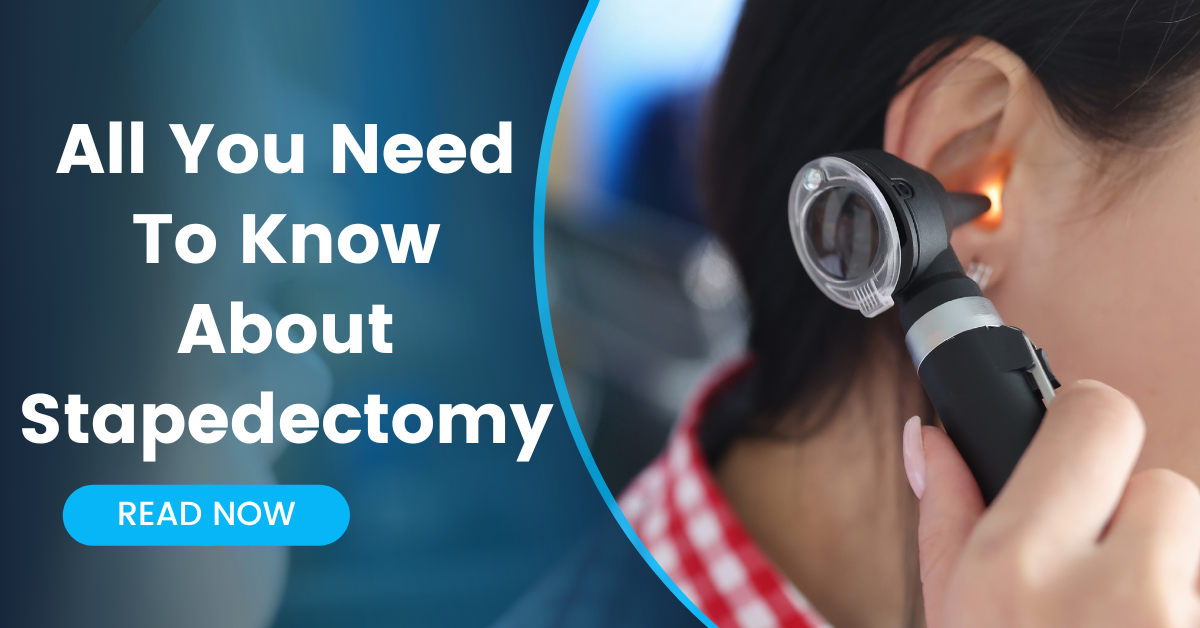 All You Need To Know About Stapedectomy – Dr Muaaz Tarabichi