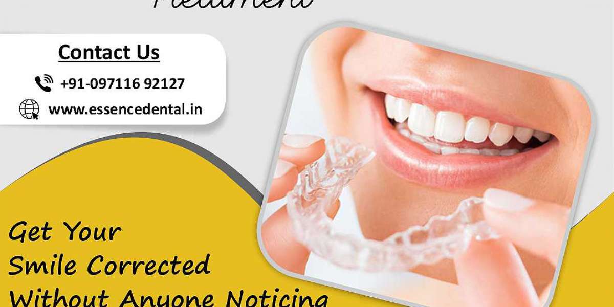 Clear Aligners A Clear Substitute for Braces