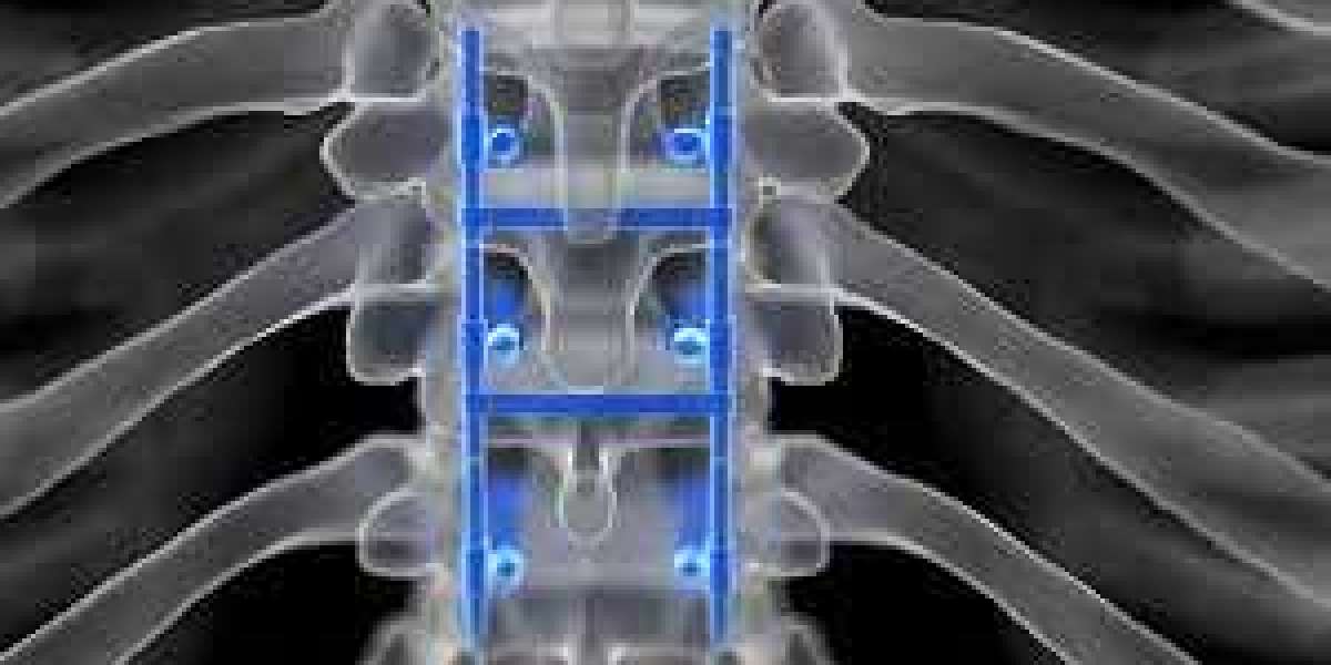 Spinal Devices Market Size Trends And Future Opportunities Till 2027