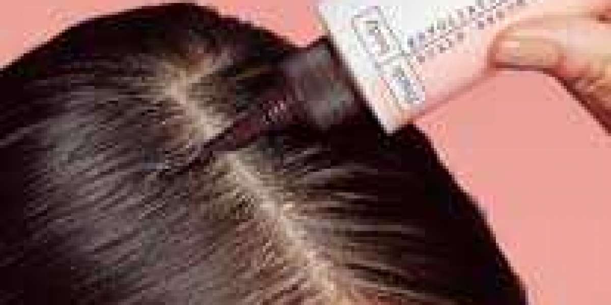Why lactic corrosive is great for your scalp and hair.?