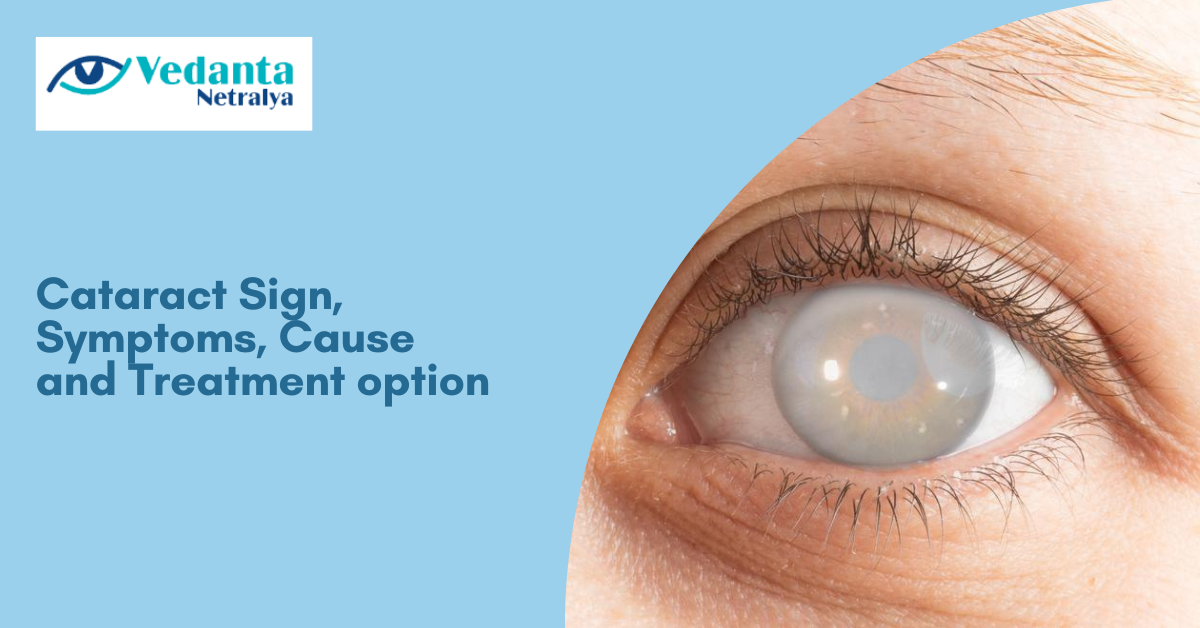 Cataract Sign, Symptoms, Cause and Treatment option | Zupyak