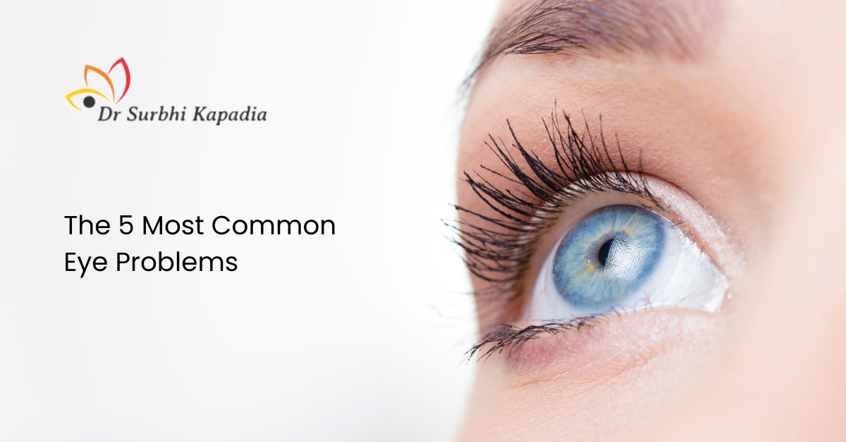 The 5 Most Common Eye Problems. Your eyes are one of the most important… | by Dr. Surbhi Kapadia | Dec, 2022 | Medium