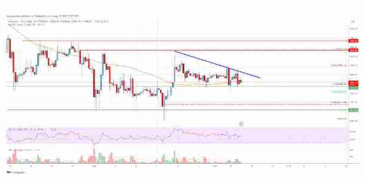 Analysis of the Ethereum Price: ETH Tests Key Support