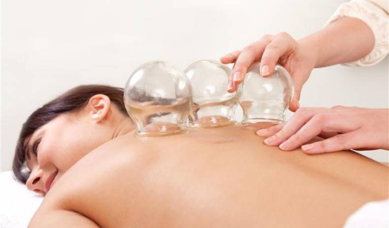 Cupping Therapy: What It Is And Why You Should Try It