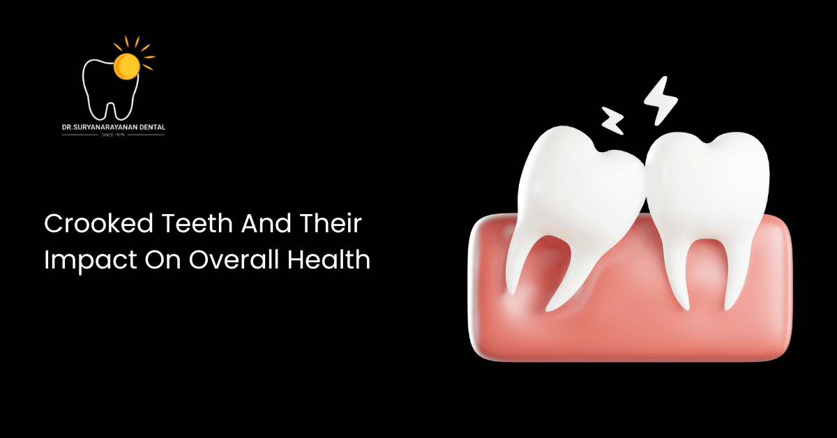 Crooked Teeth And Their Impact On Overall Health