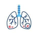 Lung Cancer Treatment Bangalore