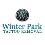 Winter Park Tattoo Removal