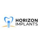 Horizon Implants