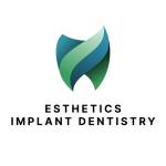 Esthetics Implant Dentistry